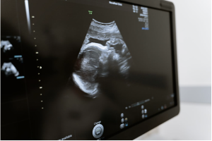 What Expecting Parents Should Know About Ultrasound Imaging