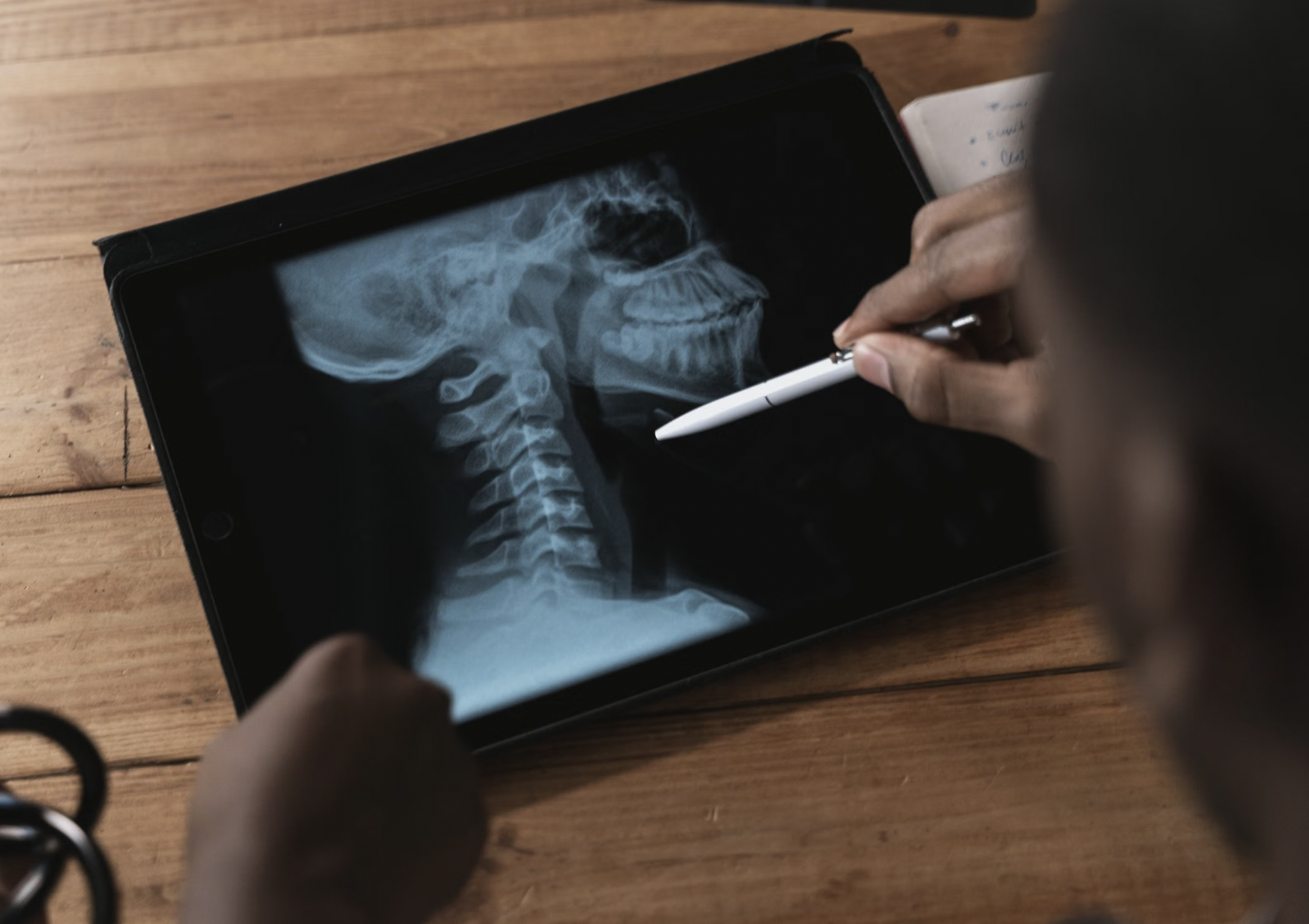 The Neck Fracture With a Name You Don't Forget