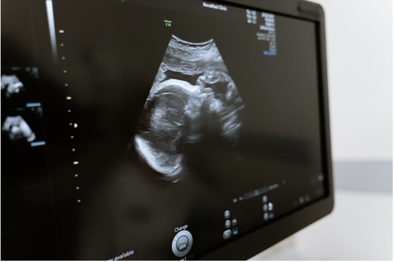 What Expecting Parents Should Know About Ultrasound Imaging